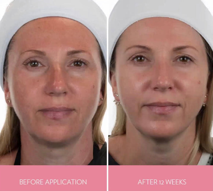Boost + Collagen Product Package