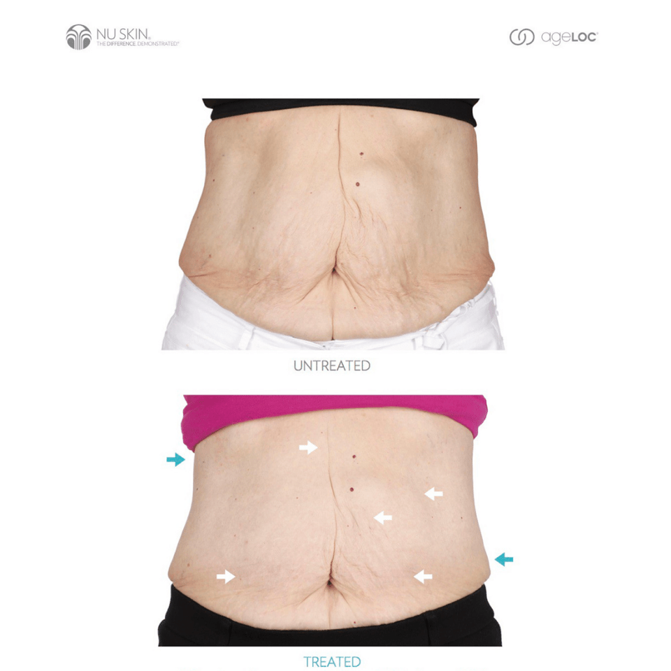 ageLOC Body Shaping Gel