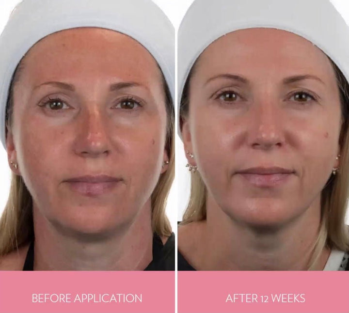 ageLOC Boost Activating Serum