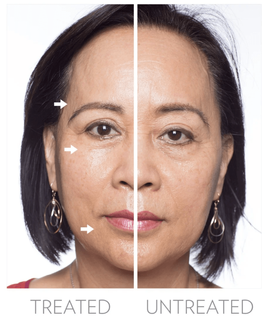 ageLOC Galvanic Spa System Gen III