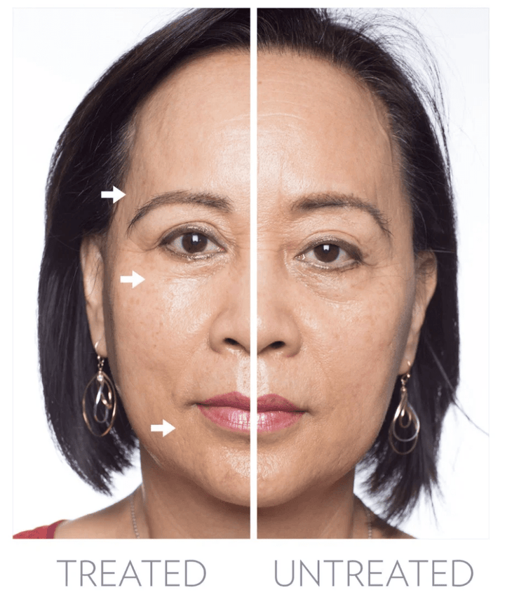 ageLOC Galvanic Spa System Gen III