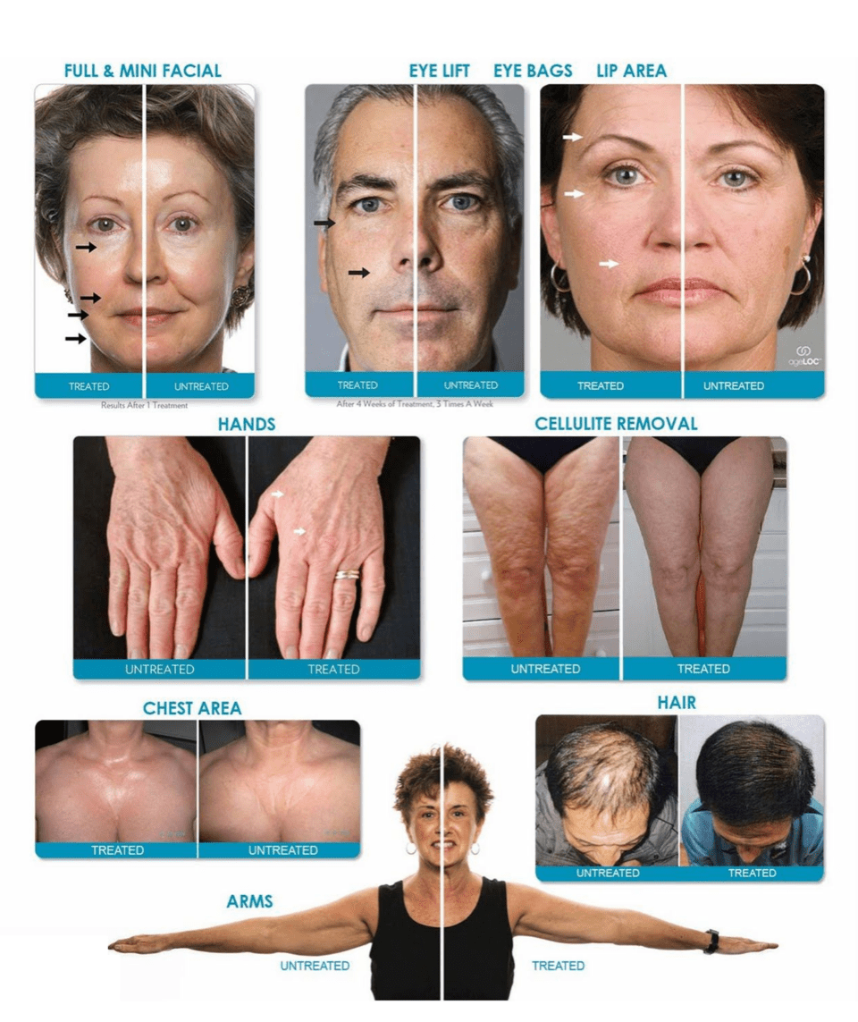ageLOC Galvanic Spa System Gen III