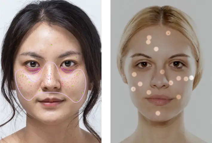 Das Bild zeigt zwei nebeneinander angeordnete Gesichtsanalyse-Overlays, die jeweils unterschiedliche Hautbehandlungszonen mit gepunkteten Markern und Konturlinien auf den Gesichtern von Frauen hervorheben.